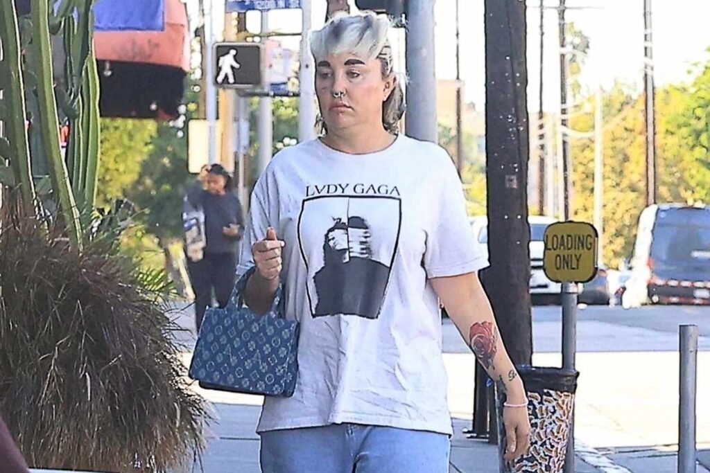 Amanda Bynes revela que perdeu quase 30 libras. em Ozempic