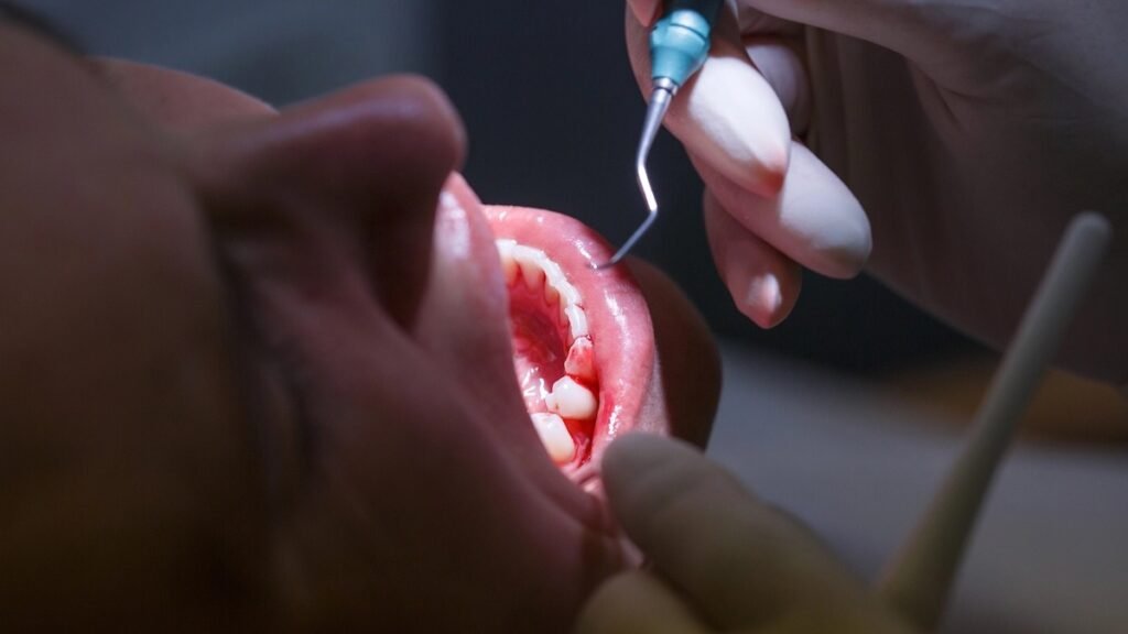 Periodontite é silenciosa e pode afetar a saúde além dos dentes