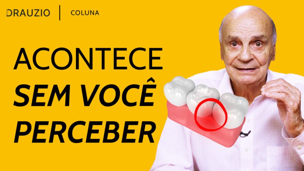 Como a periodontite pode afetar os dentes, o cérebro e o coração