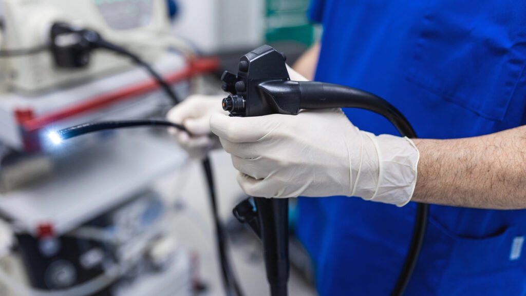 Colonoscopia: o exame que previne e detecta o câncer de intestino