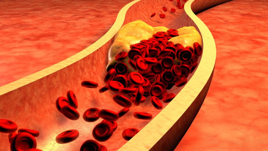HDL, LDL e mais: veja que é preciso saber sobre colesterol