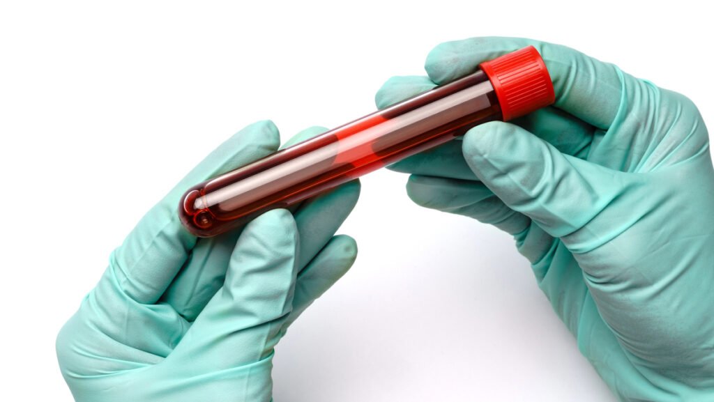 Como entender o hemograma completo e o que cada célula do sangue revela