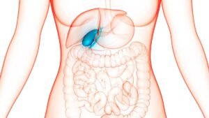 Colecistectomia: como funciona a cirurgia para retirada da vesícula