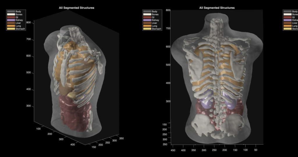 Midjourney Medical passa da geração de imagens de IA para ultrassonografias de corpo inteiro