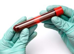 Como entender o hemograma completo e o que cada célula do sangue revela