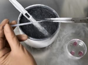Programas gratuitos para congelamento de óvulos no Brasil
