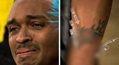 Concorrente de 'Fear Factor' perfurado por 11 agulhas em um clipe angustiante