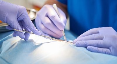 Como escolher um cirurgião plástico com segurança