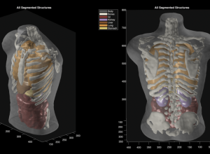 Midjourney Medical passa da geração de imagens de IA para ultrassonografias de corpo inteiro